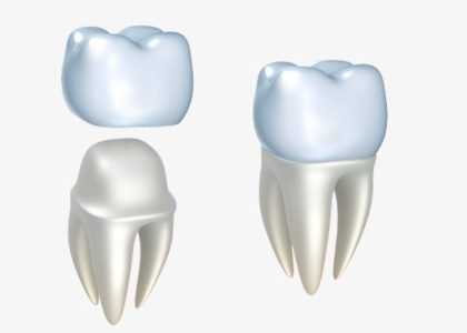 couronnes-dents-1280x720